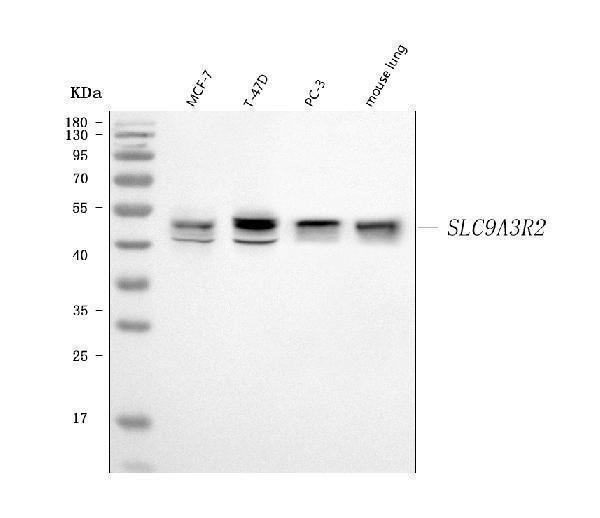  Western blot analysis of SLC9A3R2 using anti-SLC9A3R2 antibody (A05624-2)