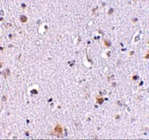 a05629 1 nup160 primary antibodies ihc testing 2