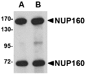 a05629 1 nup160 primary antibodies wb testing 1