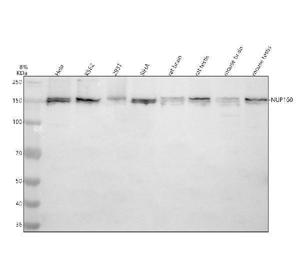 Western blot analysis of NUP160 using anti-NUP160 antibody (A05629-2)