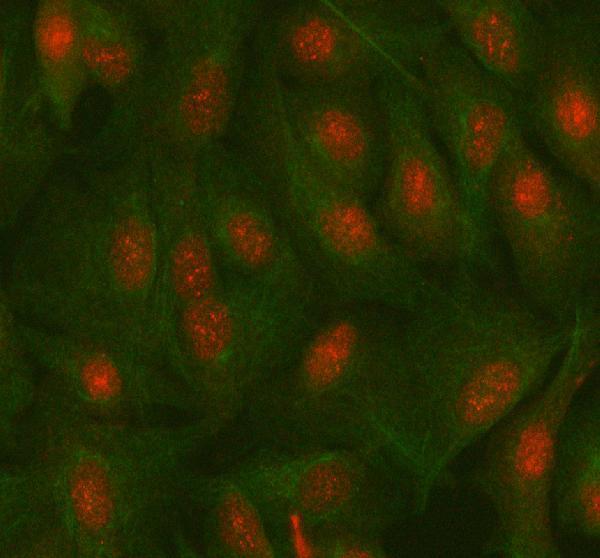  IF analysis of MAZ using anti-MAZ antibody (A05631-2) and anti-Beta Tubulin antibody (M01857-3)