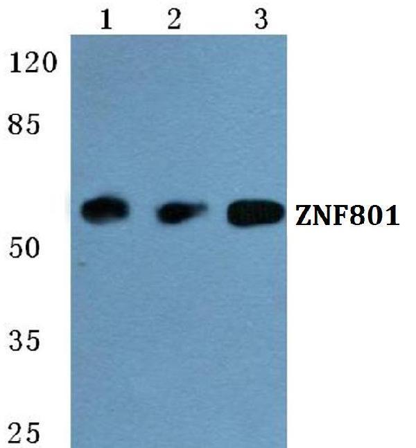 Western blot (WB) analysis of ZNF801 polyclonal antibody at 1:500 dilution
Lane1:MCF-7 cell lysate
Lane2:Raw264