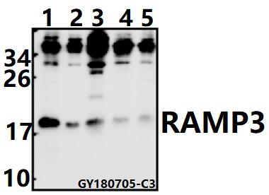 Western blot (WB) analysis of RAMP3 pAb at 1:500 dilution
Lane1:H1792 whole cell lysate(20ug)
Lane2:MCF-7 whole cell lysate(10ug)
Lane3:Myla2059 whole cell lysate(40ug)
Lane4:3T3-L1 whole cell lysate(40ug)
Lane5:PMVEC whole cell lysate(40ug)