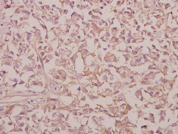 a05633 rps9 primary antiboties ihc testing 2