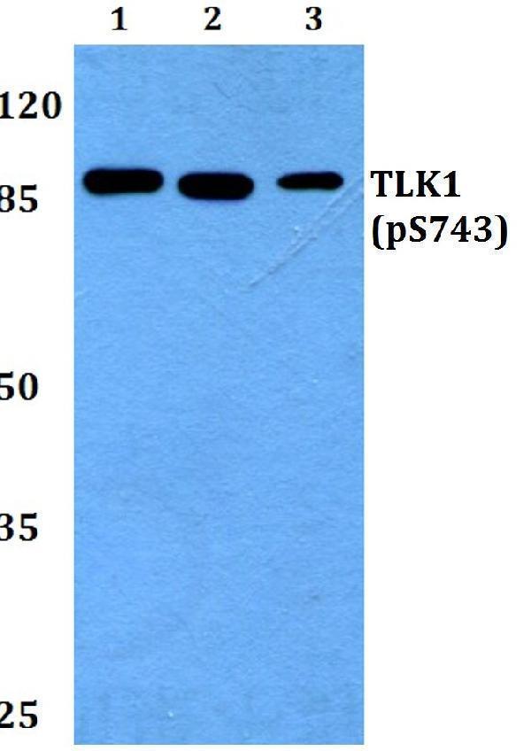 a05635s743 tlk1 primary antiboties wb testing 1