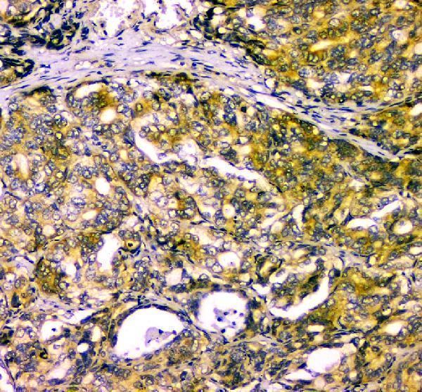 a05636 1 naa15 primary antibodies ihc testing 1