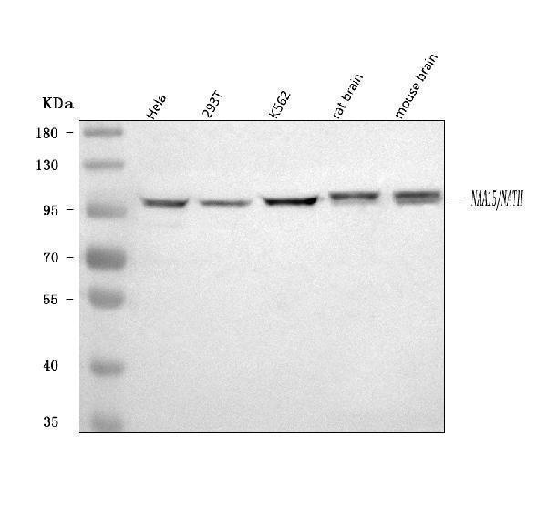  Western blot analysis of NARG1/NAA15 using anti-NARG1/NAA15 antibody (A05636-3)