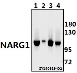Western blot (WB) analysis of NARG1 polyclonal antibody at 1:500 dilution
Lane1:The Testis tissue lysate of Rat(40ug)
Lane2:The Eye tissue lysate of Mouse(40ug)
Lane3:A375 whole cell lysate(40ug)
Lane4:SCC-7 whole cell lysate(40ug)