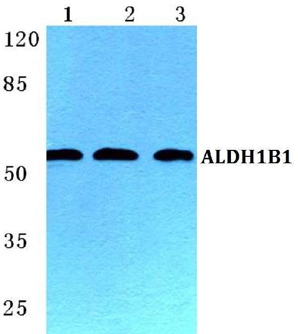 Western blot (WB) analysis of ALDH1B1 polyclonal antibody at 1:500 dilution
Lane1:HEK293T cell lysate
Lane2:Mouse spleen tissue lysate
Lane3:Rat liver tissue lysate