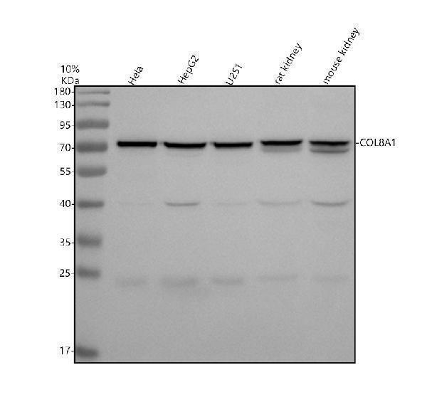 Western blot analysis of COL8A1 using anti-COL8A1 antibody (A05638-1)