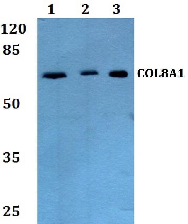 a05638 col8a1 primary antiboties wb testing 1