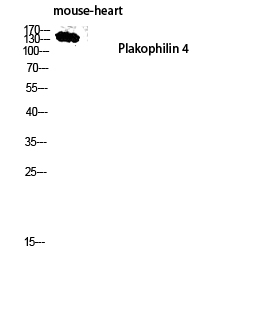 Western Blot (WB) analysis of Mouse Heart lysis using Plakophilin 4 antibody