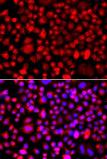 Immunofluorescence analysis of A549 cells using ALG1 antibody