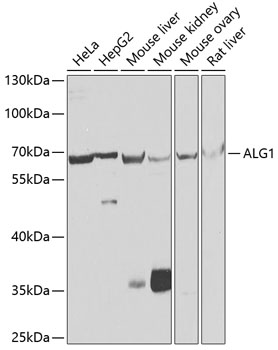 Western blot analysis of extracts of various cell lines, using ALG1 antibody