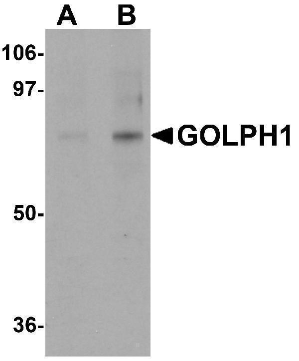 Western blot analysis of GOLPH1 in K562 cell lysate with GOLPH1 antibody at (A) 1 and (B) 2 μg/mL