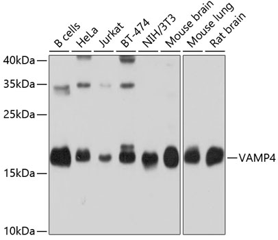 Western blot analysis of extracts of various cell lines, using VAMP4 antibody  at 1:1000 dilution