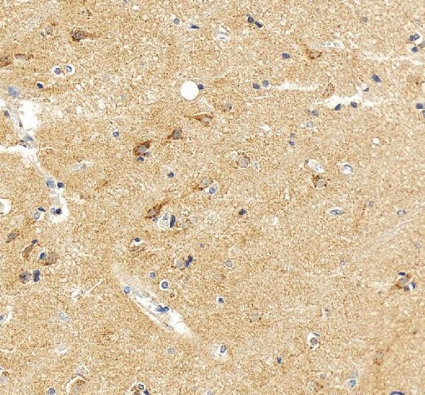 IHC analysis of VAMP4 using anti-VAMP4 antibody (A05647-2)