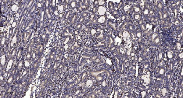 a05648 1 cyp4v2 primary antibodies ihc testing 1