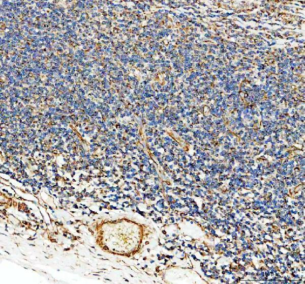 IHC analysis of COL8A2 using anti-COL8A2 antibody (A05649-1)