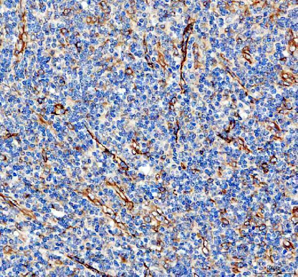 IHC analysis of COL8A2 using anti-COL8A2 antibody (A05649-1)