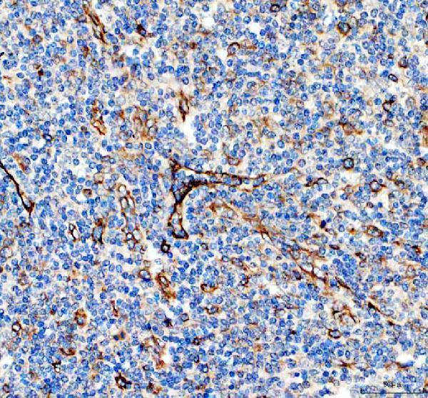 IHC analysis of COL8A2 using anti-COL8A2 antibody (A05649-1)