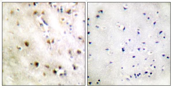 a05651 zfp36l1 primary antibodies ihc testing 1