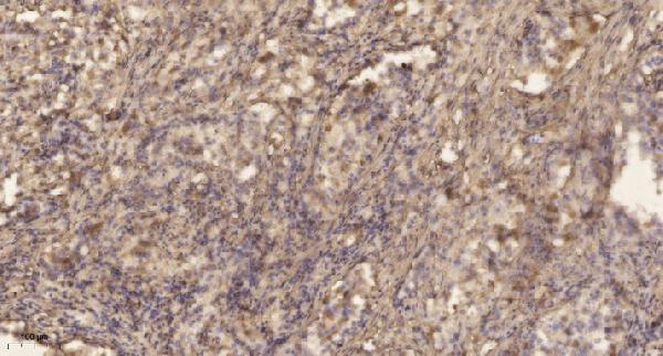 a05651s92 zfp36l1 primary antibodies ihc testing 1