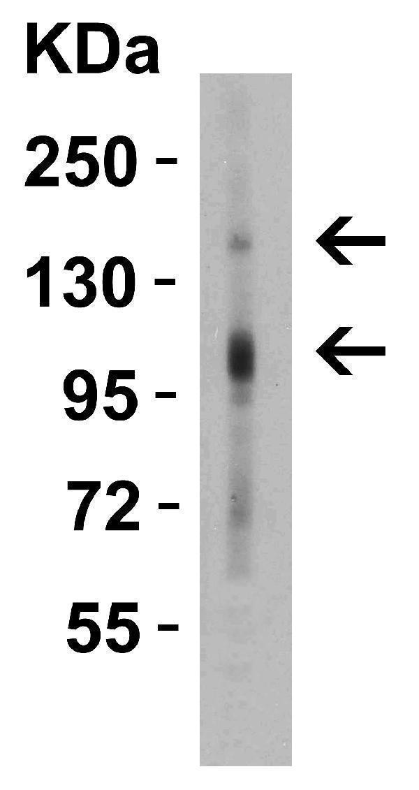 a05652 crb2 primary antibodies wb testing 1