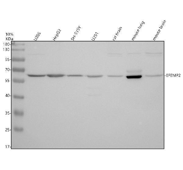 Western blot analysis of EFEMP2 using anti-EFEMP2 antibody (A05653-2)