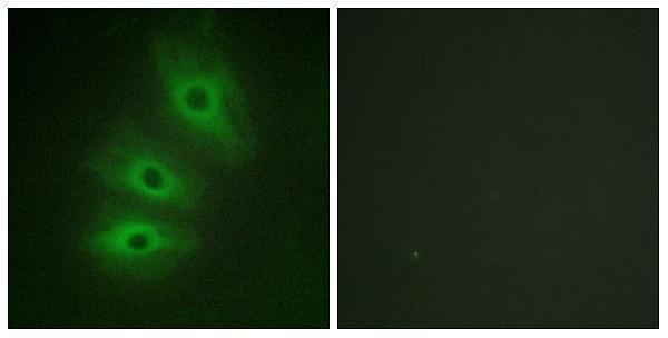 a05655 1 adcy6 primary antibodies if testing 1