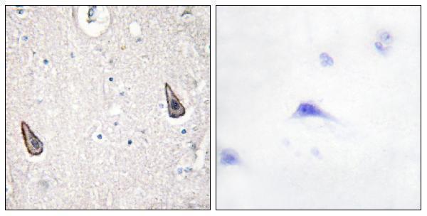 a05655 1 adcy6 primary antibodies ihc testing 2