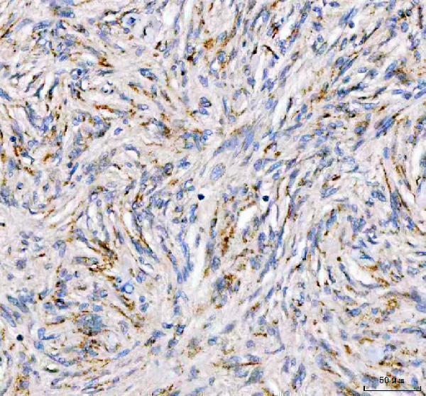  IHC analysis of PDK3 using anti-PDK3 antibody (A05658-1)