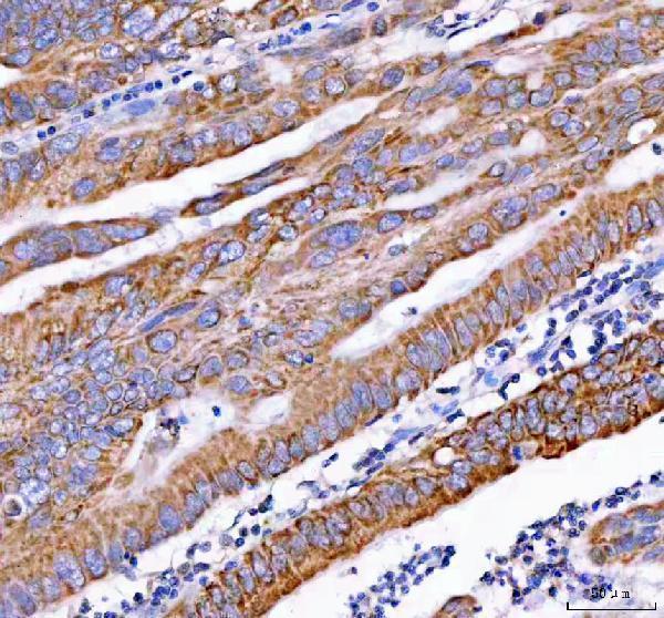  IHC analysis of PDK3 using anti-PDK3 antibody (A05658-1)