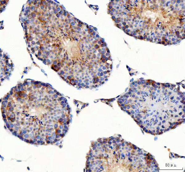 a05658 1 pdk3 primary antibodies ihc testing 4