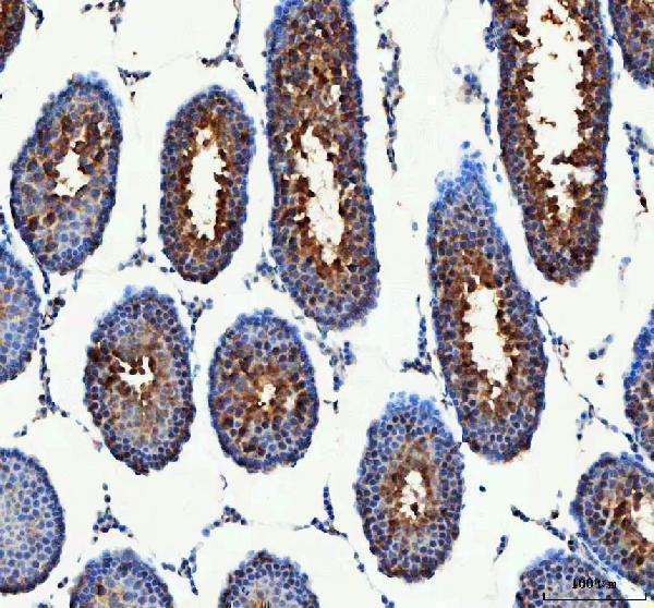 a05658 1 pdk3 primary antibodies ihc testing 5