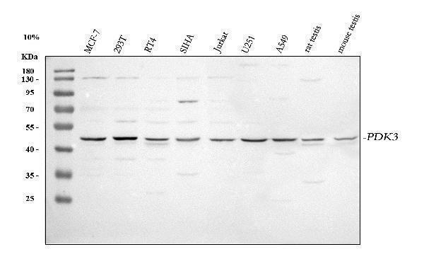  Western blot analysis of PDK3 using anti-PDK3 antibody (A05658-1)