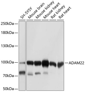 a05660 adam22 primary antiboties wb testing 1