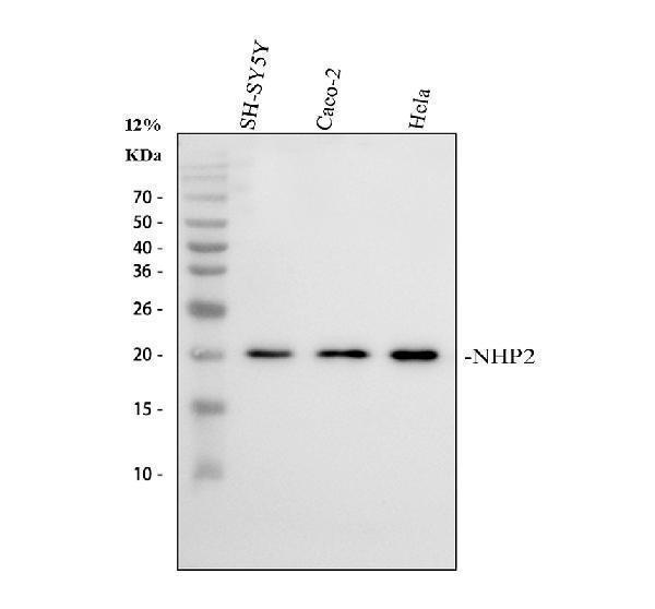  Western blot analysis of NHP2 using anti-NHP2 antibody (A04887-1)