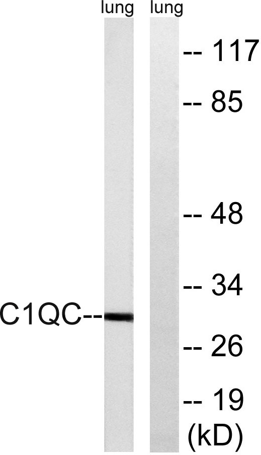 a05666 1 c1qc primary antibodies wb testing 2