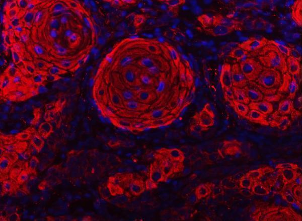  IF analysis of Cytokeratin 2e/KRT2 using anti-Cytokeratin 2e/KRT2 antibody (A05667-2)