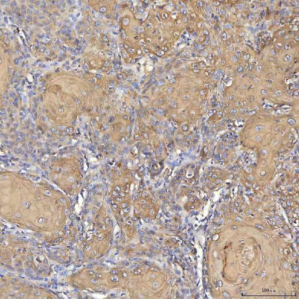  IHC analysis of Cytokeratin 2e/KRT2 using anti-Cytokeratin 2e/KRT2 antibody (A05667-2)