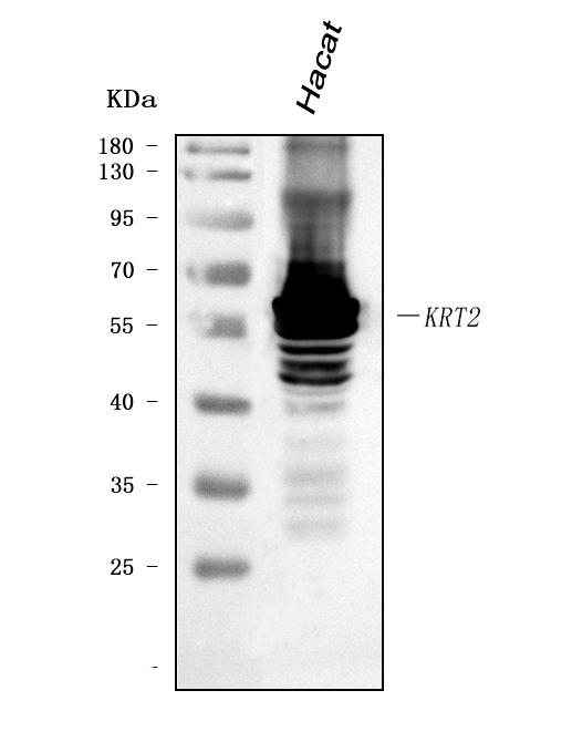  Western blot analysis of Cytokeratin 2e/KRT2 using anti-Cytokeratin 2e/KRT2 antibody (A05667-2)