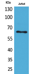 Western Blot analysis of Jurkat cells using Keratin-pan Polyclonal Antibody