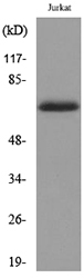 Western blot analysis of lysate from Jurkat cells, using Keratin-pan Antibody