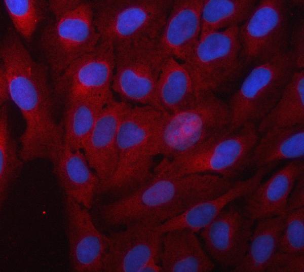 IF analysis of Alpha Taxilin/TXLNA using anti-Alpha Taxilin/TXLNA antibody (A05668-1)