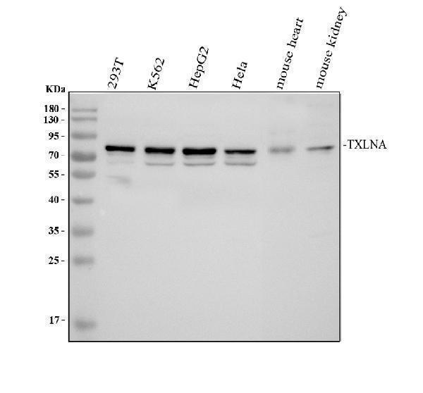Western blot analysis of Alpha Taxilin/TXLNA using anti-Alpha Taxilin/TXLNA antibody (A05668-1)