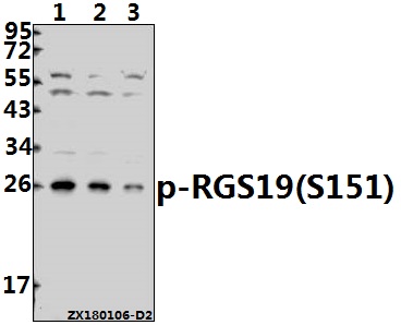 a05669s151 rgs19 primary antiboties wb testing 1