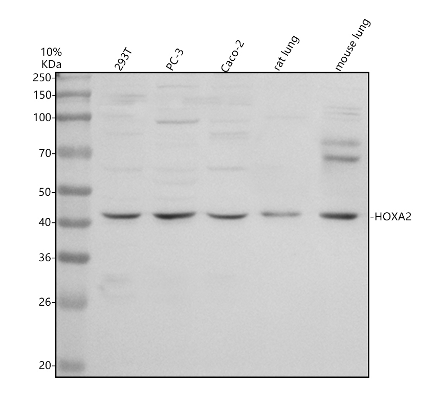 a05671 1 hoxa2 primary antibodies wb testing 1