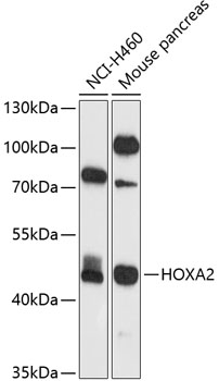 Western blot analysis of extracts of various cell lines, using HOXA2 antibody  at 1:1000 dilution