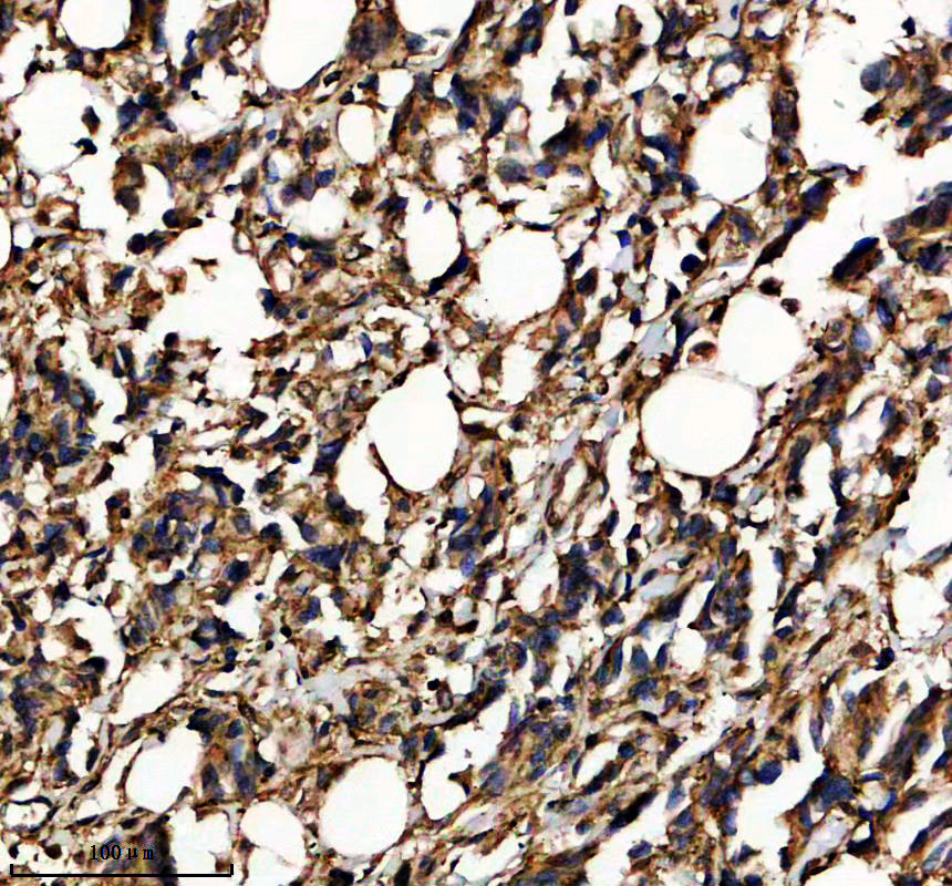 IHC analysis of Frizzled 2/FZD2 using anti-Frizzled 2/FZD2 antibody (A05675-2)